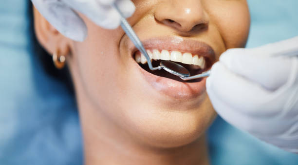 Best Weekend Emergency Dentist in Converse, TX