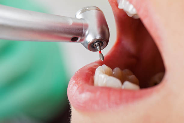 Best Emergency TMJ Treatment in Converse, TX